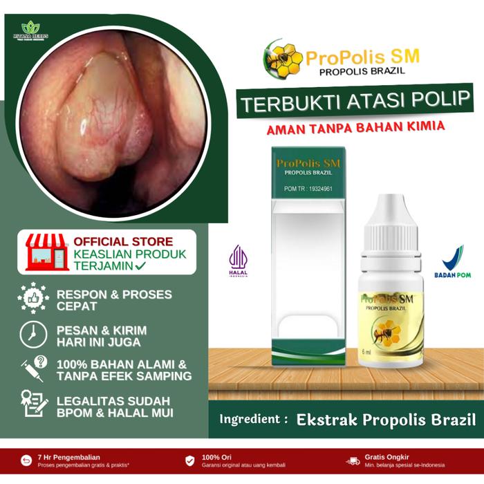 OBAT HIDUNG POLIP - OBAT HIDUNG BAU BUSUK - OBAT POLIP HIDUNG - OBAT HIDUNG BERAIR - OBAT HIDUNG BEN