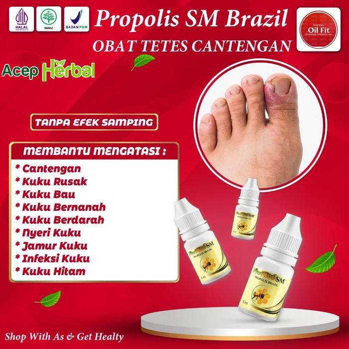 OBAT CANTENGAN KUKU TANGAN DAN KAKI BENGKAK BERNANAH BAU CANTENGAN PARAH JEMPOL KAKI CANTENGAN KUKU 
