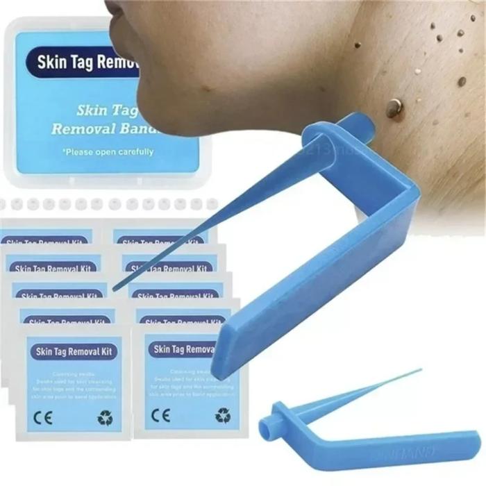 Skin Care Rubber Bands Skin Tag Remover Skin Tag Removal Kit Face Care Mole Wart Tool Skincare Green