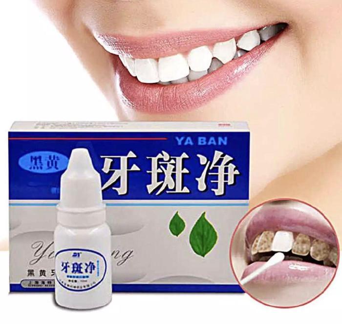 Pemutih Gigi VERSIDENT Shining Bright Teeth Pembersih Karang Gigi Efek