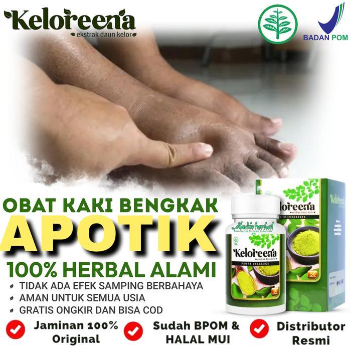 Obat kaki bengkak di apotik - Sakit engkel, Keseleo Terkilir - Samulin