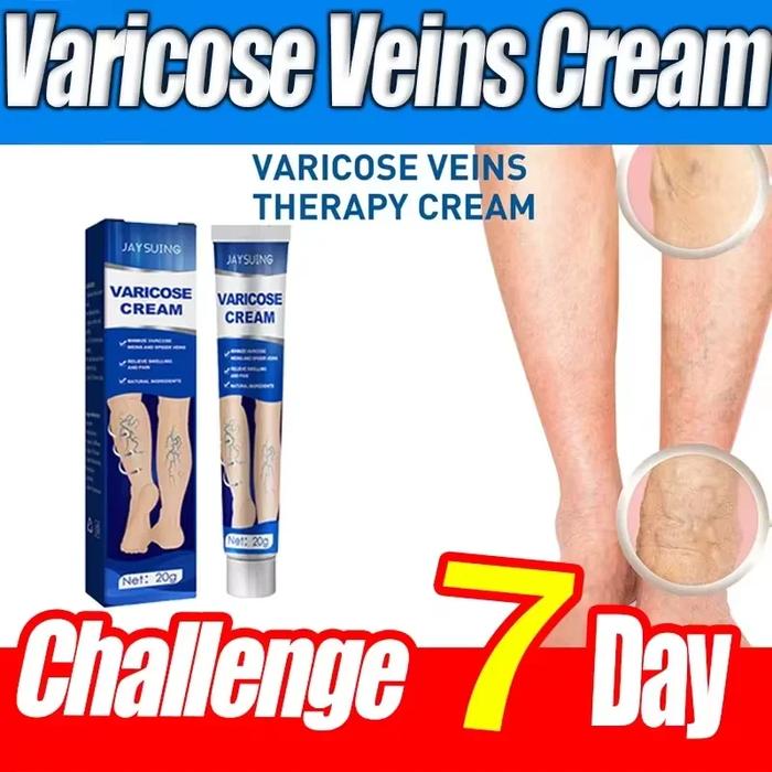 Ointment for Varicose Veins Eliminate Vasculitis Phlebitis to Relieve Spider Leg Pain Treatment Herb