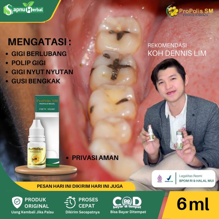 OBAT SAKIT GIGI BERLUBANG AGAR COPOT, GUSI BENGKAK, GIGI SAKIT DAN LINU, NYERI GIGI, PEREDA SAKIT GI