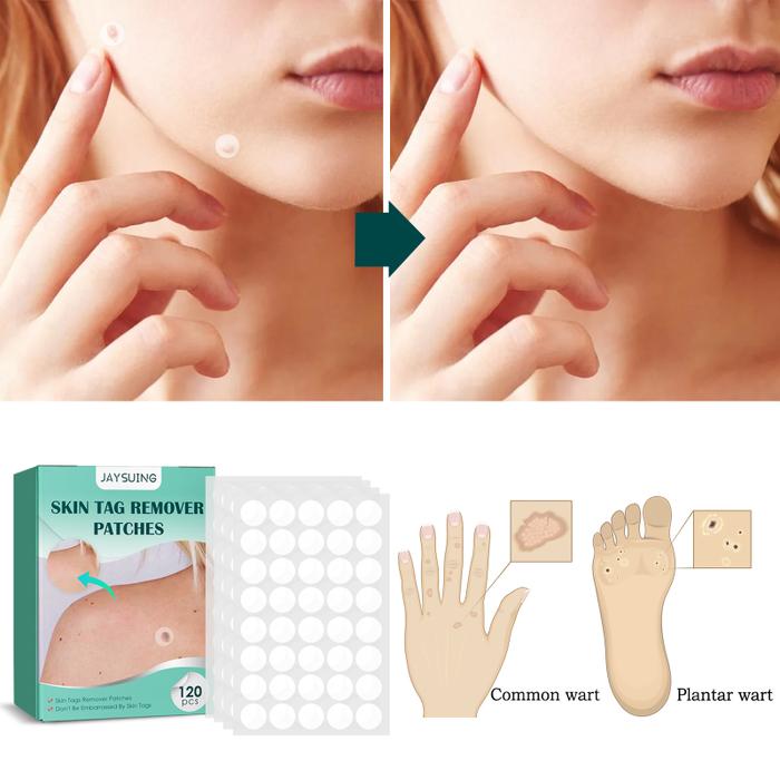 Warts Remover Plaster Skin Tags Remover Wart Treat ment patch