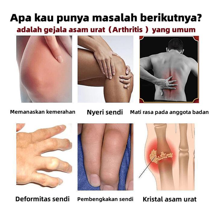 Obat Sakit Lutut Sakit Pinggang Nyeri Sendi Lutut Kaki Bee Venom Cream Nyeri Tulang Nyeri Sendi Rada