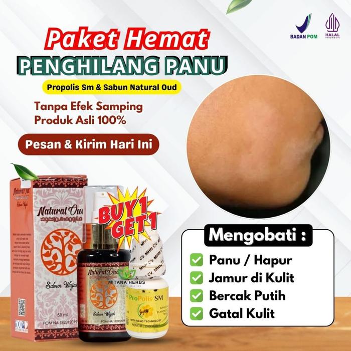 SABUN PANU / OBAT PANU - SABUN PANU KADAS KURAP - SABUN PANU DI WAJAH - SABUN PANU BADAN - SABUN PAN