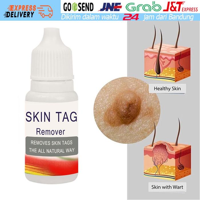 SKIN TAG Cair | Obat Alami Penghilang Kutil Tahi Lalat Dll - PENGHILANG KUTIL TAHI LALAT AMPUH