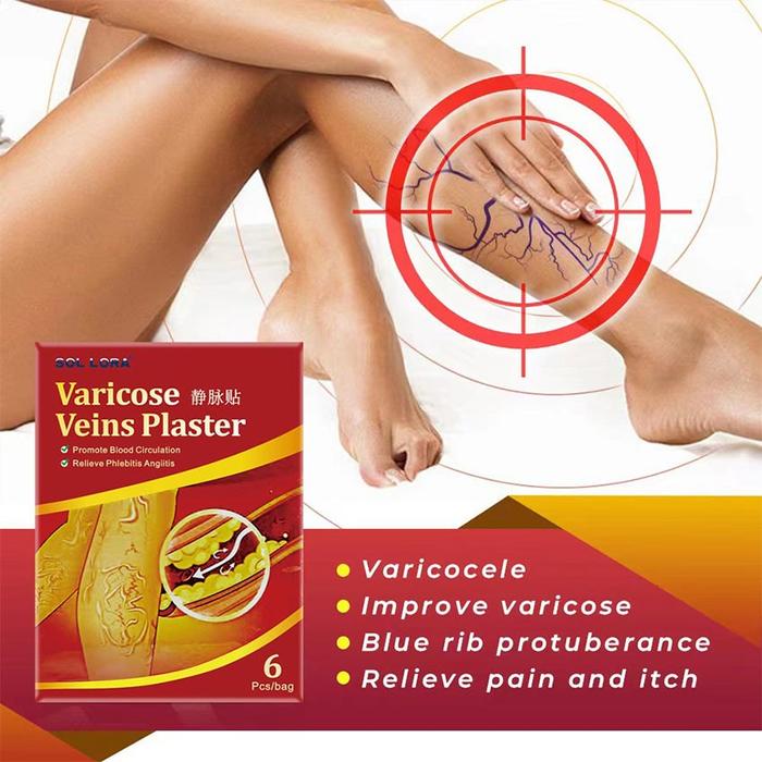 koyo krim salep herbal penghilang varises herbal varicose veins patch ointment