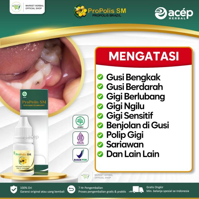 OBAT GUSI BENGKAK GUSI BERDARAH GIGI BERLUBANG ABSES GIGI GUSI BERNANAH SARIAWAN - PROPOLIS SM 6 ML