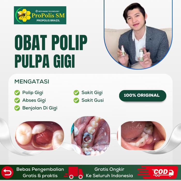 MAFAZA HERBS - OBAT POLIP GIGI, OBAT POLIP PULPA, OBAT ABSES GIGI, OBAT BENJOLAN DI GIGI, OBAT SAKIT