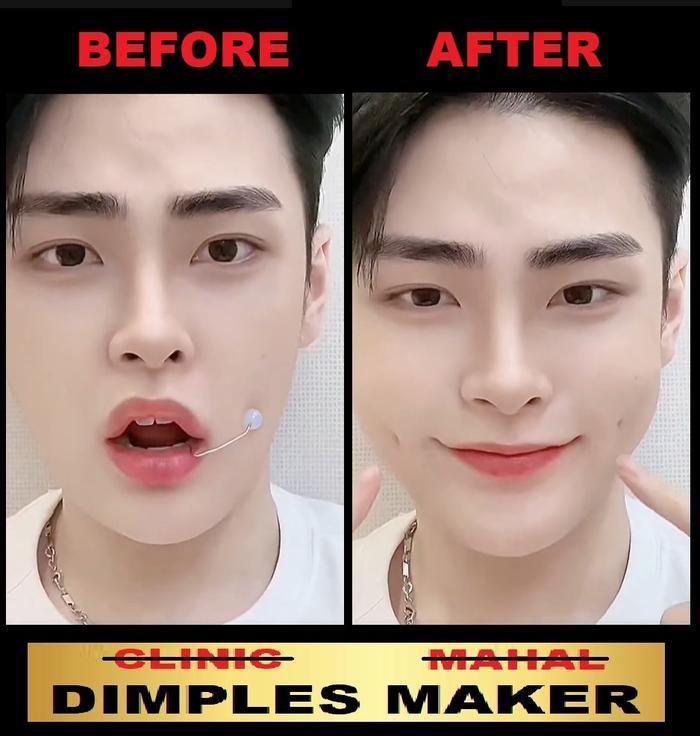 ALAT PEMBUAT LESUNG PIPI Dimple Maker clip PEMBUAT LESUNG PIPIT anting