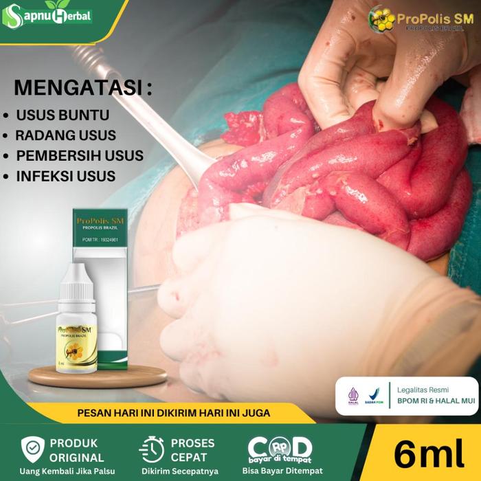 Obat Usus Buntu Radang Usus Kram Usus Infeksi Usus Pembers Usus Kotor Usus Melilit Usus Buntu Pecah