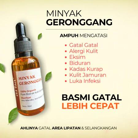 Minyak Geronggang Alami untuk Mengatasi Gatal, Jerawat, dan Flek Hitam Dijamin ORI