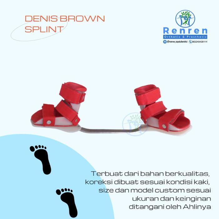 Sepatu bayi dennis brown splint buat koreksi kaki CTEV kaki bengkok