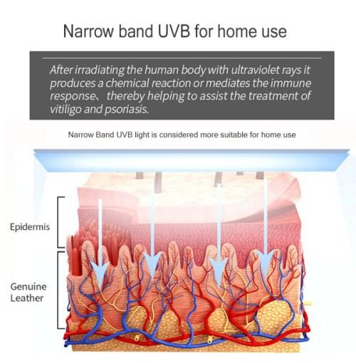 terbaru FAMARKET LAMPU LED UVB 311NM FOTOTERAPI UV VITILIGO KIT