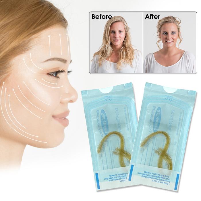 Kecantikan Wajah, Benang Wajah Collagen, Pengisian Wajah Kolagen