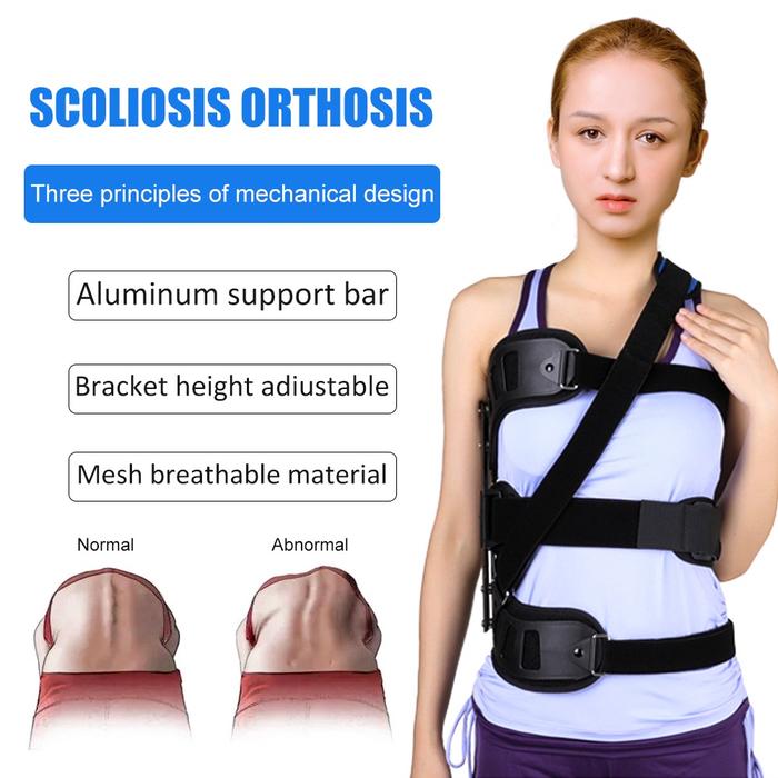 Ober scoliosis pelurus tulang belakang bengkok orthosis fiksasi terapi