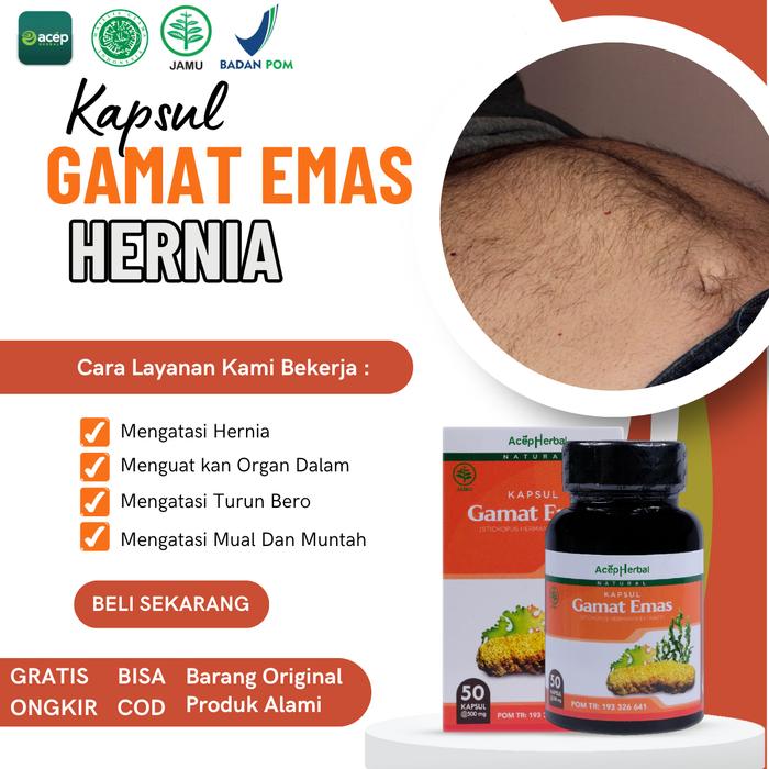 Obat Hernia, Hernia Turun Berok, Hernia Inguinalis, Hernia Femoralis,
