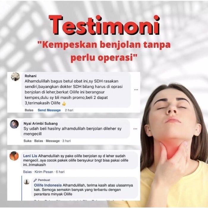 BENJOLAN KEMPES DALAM 6 HARI - Oilife Minyak Oles Benjolan, Oilife Obat Benjolan, Obat Benjolan Yang