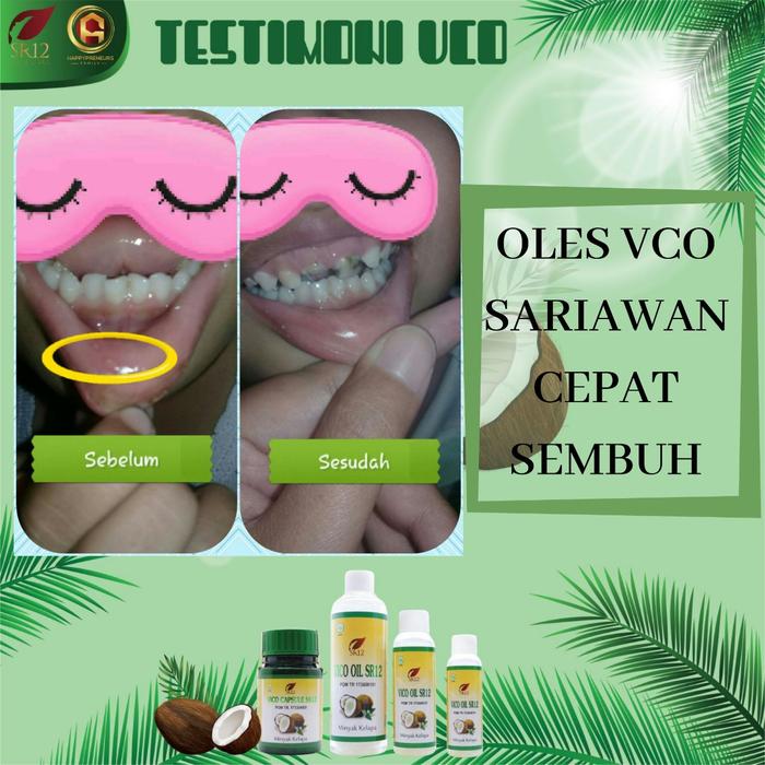 (BAYAR COD) VIRGIN COCONUT OIL (VICO/VCO) 250ml / Minyak kelapa murni SR12 atasi Ruam popok / biang 