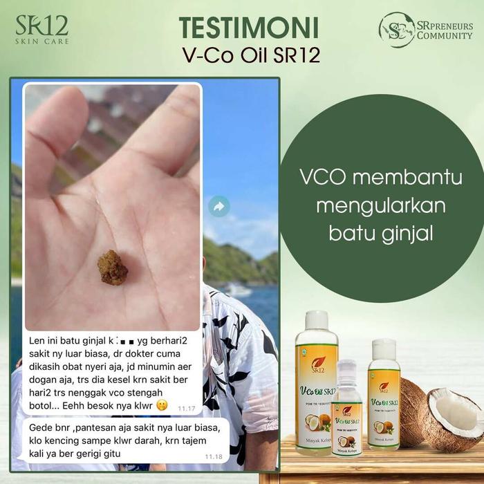 SR12 VIRGIN COCONUT OIL VCO 60ml 100ml 250ml HERBAL HALAL BPOM MEDAN