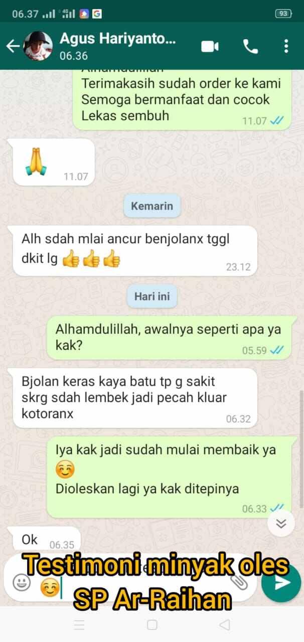 ( TERLARIS ) MINYAK OLES BENJOLAN AR RAIHAN PALING AMPUH - MENGATASI BENJOLAN - GANGLION - Lipoma. O