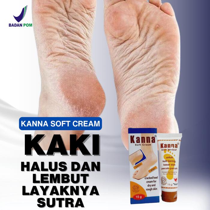 Kanna Cream Obat Krim Untuk Kaki Pecah Pecah Salep Gatal Kapalan Kutu Air Pada Kulit Kering Dan Kasa