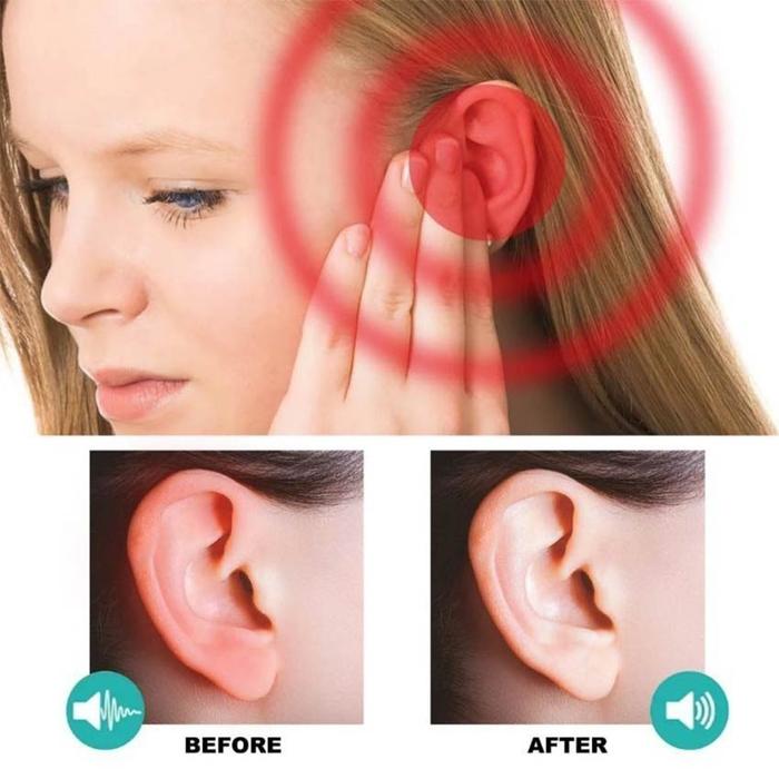 STORE ABADI - Obat Telinga Berdengung Ear Health Patch Efek cepat / meredakan tinitus Pengobatan Tin