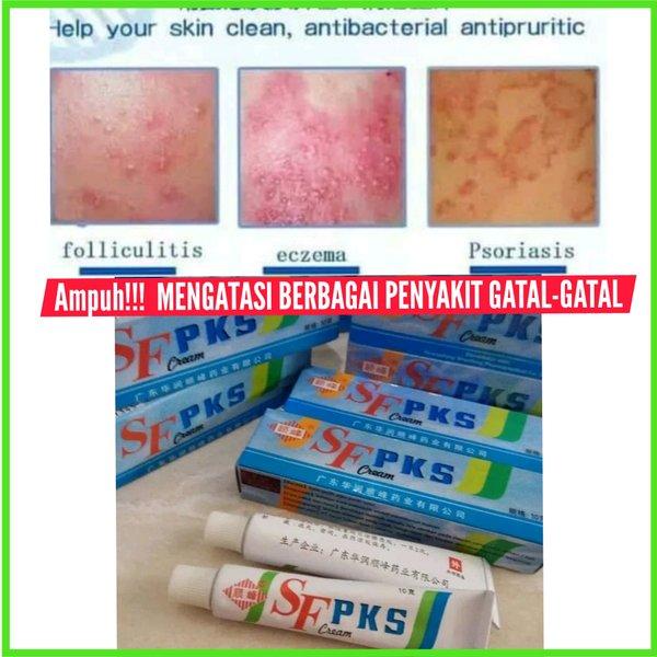 SALEP SF PKS - CREAM PIKANGSHUANG - Salap gatel gatel KL BL HL PKW asli - Obat kulit gatal EKSIM s M