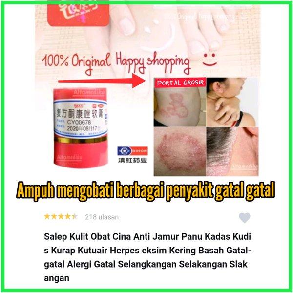 Salep Kulit Obat Cina - China Anti Jamur Panu Kadas Kudis Kurap Kutuair Herpes eksim Kering Basah Ga