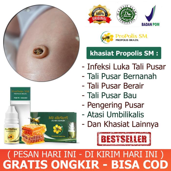 OBAT INFEKSI LUKA TALI PUSAR BAYI TALI PUSAR BAYI BERNANAH DAN BERAIR BAU GRANULOMA UMBILIKALIS HERB