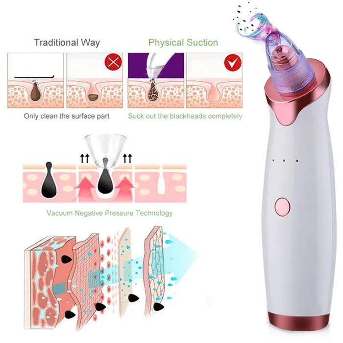 Alat Pembersih Komedo Penyedot Komedo Listrik Wajah Jerawat Pori Cleaner Vakum BlackHead Remover